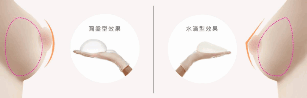圓盤及水滴型植體植入效果