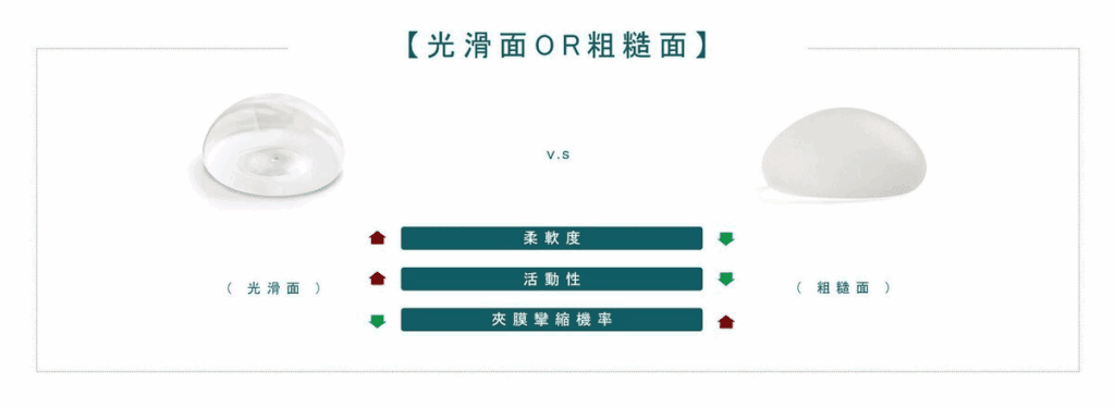 義乳光滑面和粗糙面的比較（圖片來源：法喬醫美－Sebbin香榭柔滴與Motiva魔滴該怎麼選擇？）