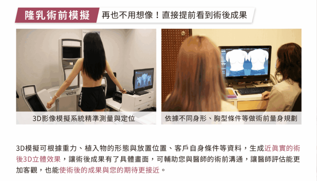 法喬隆乳術前 3D 模擬 